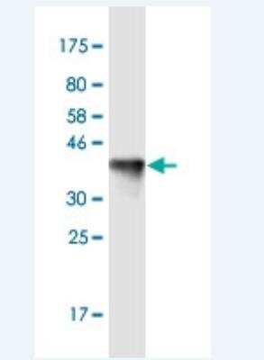 Western Blot: KIF13B Antibody (6E11) [H00023303-M01-100ug]