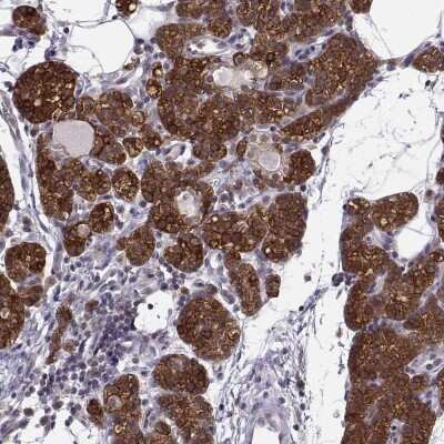 Immunohistochemistry-Paraffin: KIF13B Antibody [NBP1-83398]