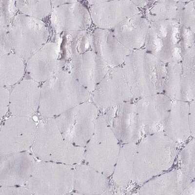 Immunohistochemistry-Paraffin: KIF13B Antibody [NBP1-83398]