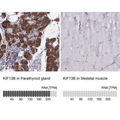 Immunohistochemistry-Paraffin: KIF13B Antibody [NBP1-83398]