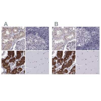 Immunohistochemistry-Paraffin: KIF13B Antibody [NBP1-83398]