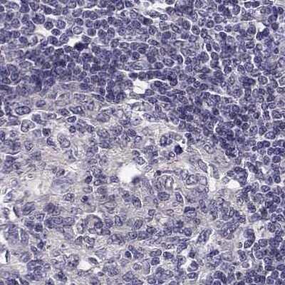 Immunohistochemistry-Paraffin: KIF13B Antibody [NBP1-83398]