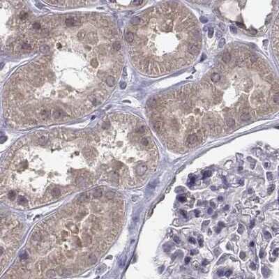 Immunohistochemistry-Paraffin: KIF13B Antibody [NBP1-83398]