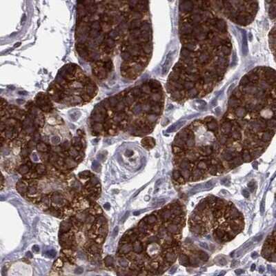 Immunohistochemistry-Paraffin: KIF13B Antibody [NBP1-83398]