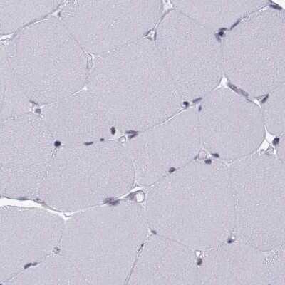 Immunohistochemistry-Paraffin: KIF13B Antibody [NBP1-83398]