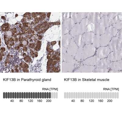 Immunohistochemistry-Paraffin: KIF13B Antibody [NBP2-62619]