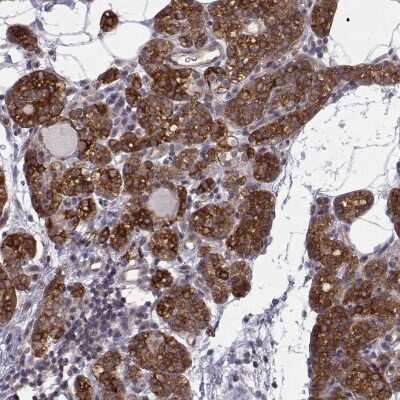 Immunohistochemistry-Paraffin: KIF13B Antibody [NBP2-62619]