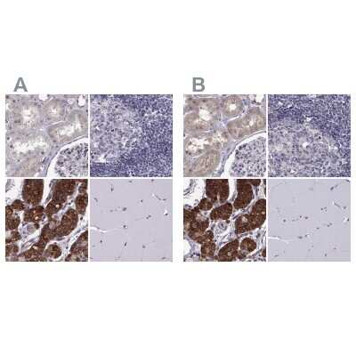 Immunohistochemistry-Paraffin: KIF13B Antibody [NBP2-62619]