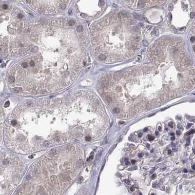 Immunohistochemistry-Paraffin: KIF13B Antibody [NBP2-62619]
