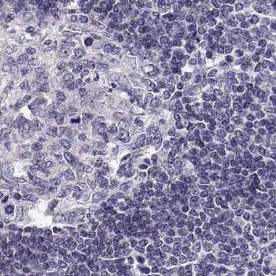 Immunohistochemistry-Paraffin: KIF13B Antibody [NBP2-62619]
