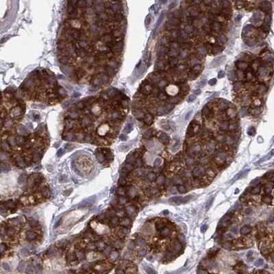 Immunohistochemistry-Paraffin: KIF13B Antibody [NBP2-62619]