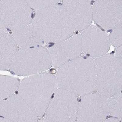 Immunohistochemistry-Paraffin: KIF13B Antibody [NBP2-62619]