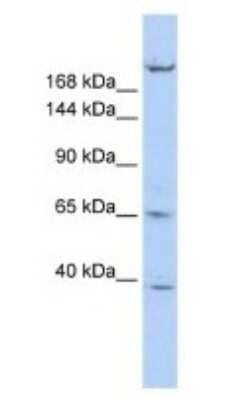 Western Blot: KIF13B Antibody [NBP1-58258]