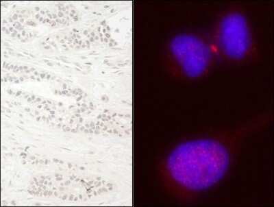 Immunohistochemistry: KIF14 Antibody [NB110-40678]