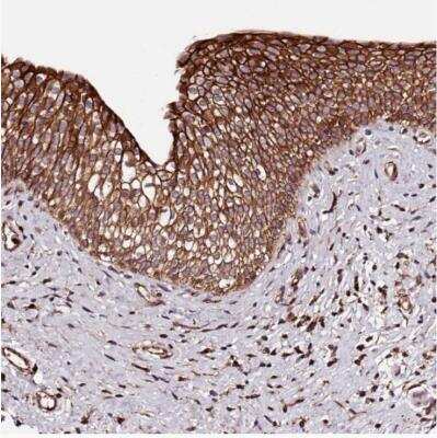 Immunohistochemistry-Paraffin: KIF14 Antibody [NBP1-83055]