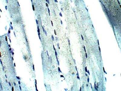 Immunohistochemistry-Paraffin: KIF14 Antibody [NBP3-12320]