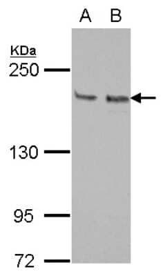 Western Blot: KIF14 Antibody [NBP2-17047]