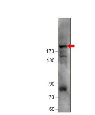 Western Blot: KIF14 Antibody [NBP3-12320]