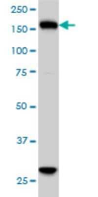 Western Blot: KIF15 Antibody (4D4) [H00056992-M01]