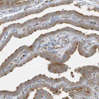 Immunohistochemistry-Paraffin: KIF15 Antibody [NBP2-34009]