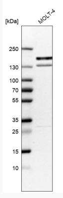 Western Blot: KIF15 Antibody [NBP1-83252]