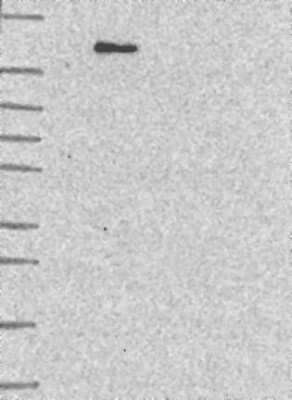 Western Blot: KIF15 Antibody [NBP3-17874]