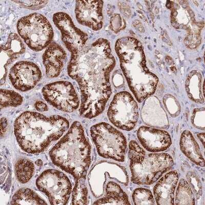 Immunohistochemistry-Paraffin: KIF16B Antibody [NBP2-14157]