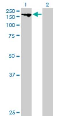 Western Blot: KIF16B Antibody [H00055614-B01P]