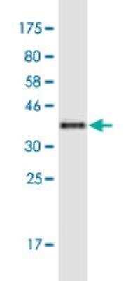 Western Blot: KIF17 Antibody (7C6) [H00057576-M04-100ug]