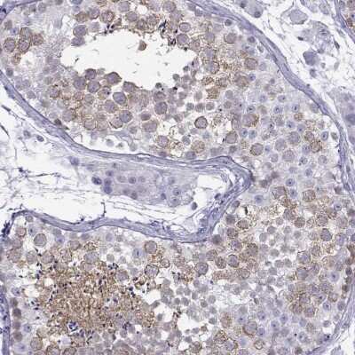 Immunohistochemistry-Paraffin: KIF17 Antibody [NBP1-81409]