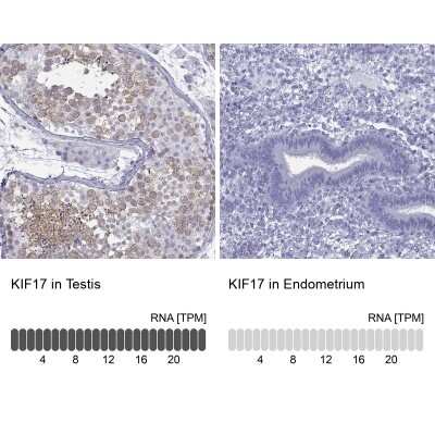 Immunohistochemistry-Paraffin: KIF17 Antibody [NBP1-81409]