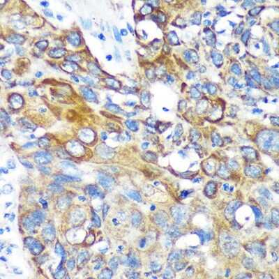 Immunohistochemistry-Paraffin: KIF17 Antibody - Azide and BSA Free [NBP3-04986]