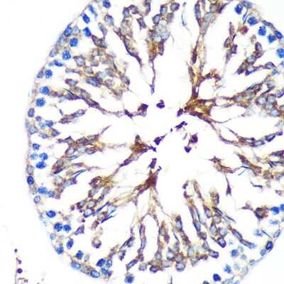 Immunohistochemistry-Paraffin: KIF17 Antibody - Azide and BSA Free [NBP3-04986]