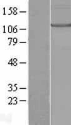 Western Blot: KIF17 Overexpression Lysate [NBL1-12287]