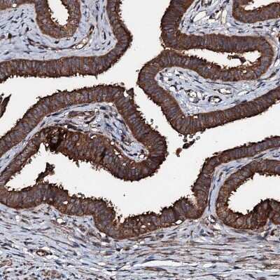 Immunohistochemistry-Paraffin: KIF18A Antibody [NBP1-85126]