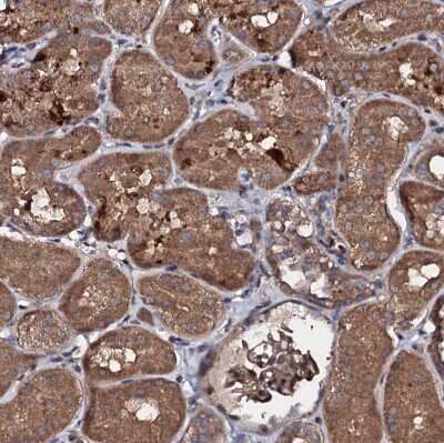Immunohistochemistry-Paraffin: KIF18A Antibody [NBP1-85126]