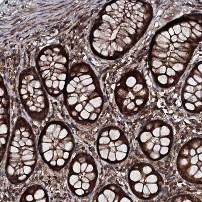 Immunohistochemistry-Paraffin: KIF18A Antibody [NBP1-85126]