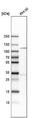 Western Blot: KIF18A Antibody [NBP1-85127]