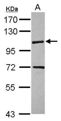 Western Blot: KIF18A Antibody [NBP2-17049]