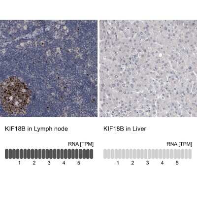 Immunohistochemistry-Paraffin: KIF18B Antibody [NBP1-90882]