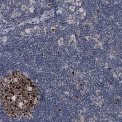 Immunohistochemistry-Paraffin: KIF18B Antibody [NBP1-90882]