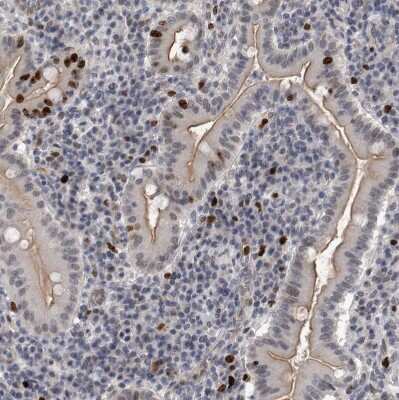 Immunohistochemistry-Paraffin: KIF18B Antibody [NBP1-90882]