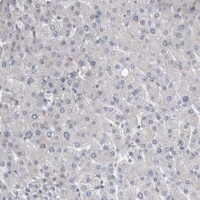 Immunohistochemistry-Paraffin: KIF18B Antibody [NBP1-90882]