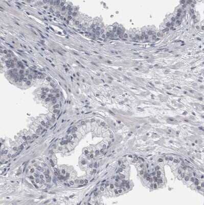 Immunohistochemistry-Paraffin: KIF18B Antibody [NBP1-90882]