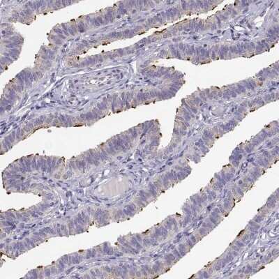 Immunohistochemistry-Paraffin: KIF19 Antibody [NBP2-57895]
