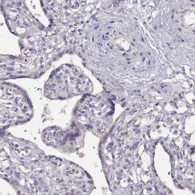 Immunohistochemistry-Paraffin: KIF19 Antibody [NBP2-57895]