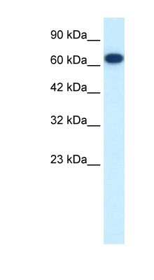 Western Blot: KIF19 Antibody [NBP1-58168]