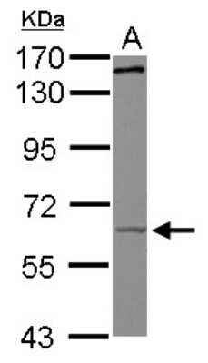 Western Blot: KIF19 Antibody [NBP2-17050]