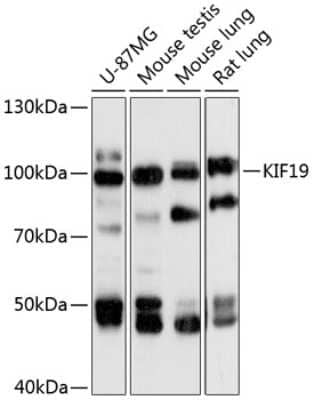 Western Blot: KIF19 AntibodyAzide and BSA Free [NBP3-04646]