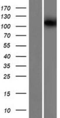 Western Blot: KIF19 Overexpression Lysate [NBP2-05273]